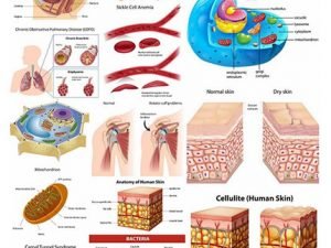 Medical Infographics