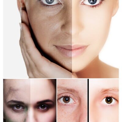 Skin Photoshop Action