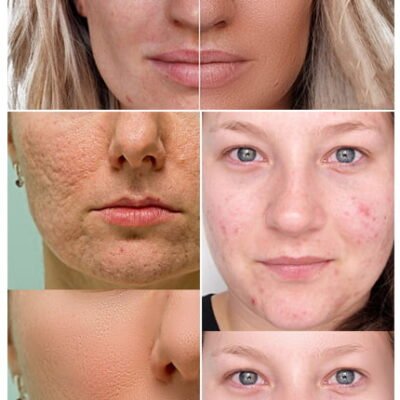 Ultimate Skin Retouch Photoshop Action