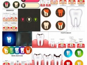 Dental Design